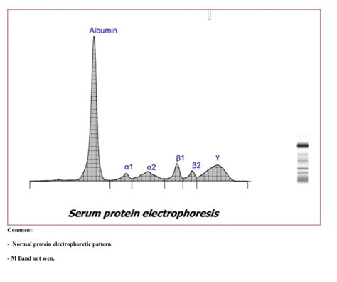 vomol|On the Applicability of Electrophoresis for Protein。